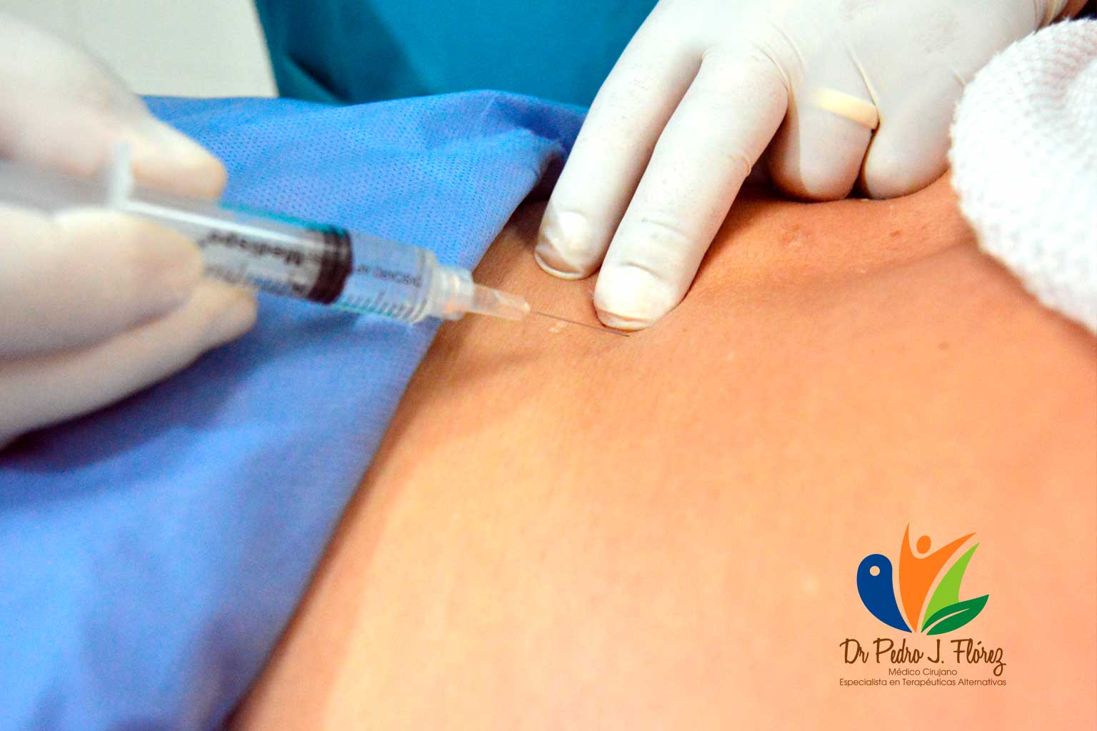 Terapia Neural Dr Pedro Javier Florez